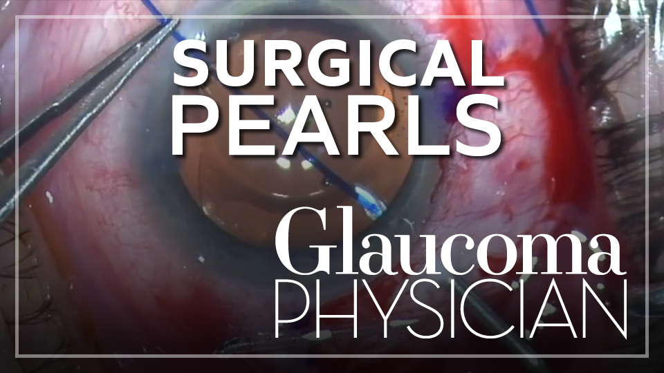 Surgical Pearls