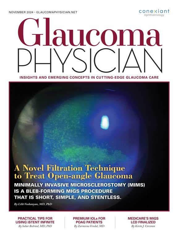 Glaucoma Physician